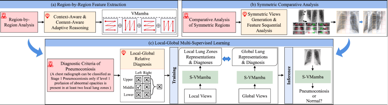 Radiologist-inspired Symmetric Local-Global Multi-Supervised Learning for early diagnosis of pneumoconiosis