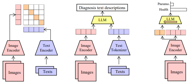 PneumoLLM: Harnessing the Power of Large Language Model for Pneumoconiosis Diagnosis